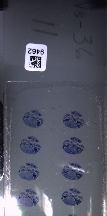 Media type: image; Special Collections 3102   shows specimen_part histological serial section;  Description: Whole slide scan, SC-3102, slide 11;